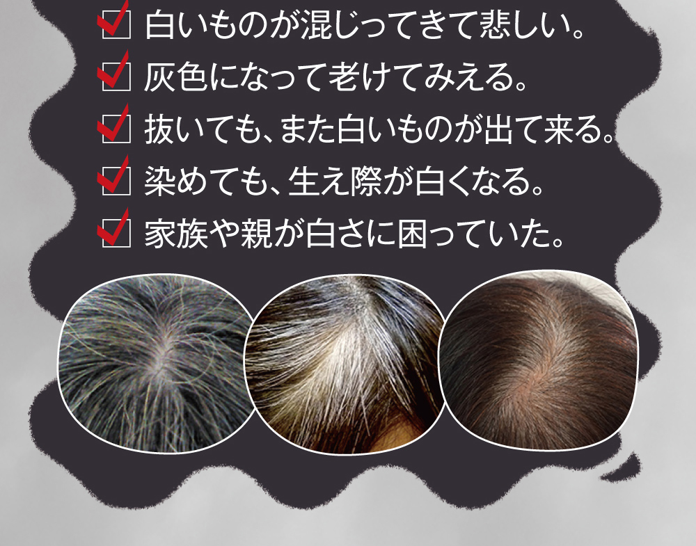 抜いても白いものが出てくる。染めても生え際が白くなる。白いものが混じってきて悲しい。などなど・・・