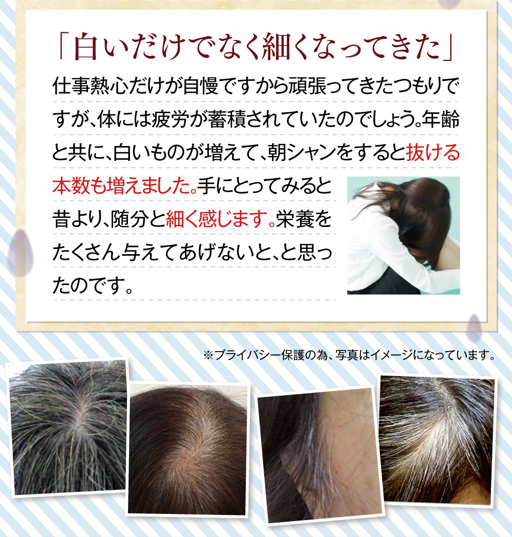 「白いだけでなく細くなってきた」仕事熱心だけが自慢ですから頑張ってきたつもりですが、体には疲労が蓄積されていたのでしょう。年齢と共に、白いものが増えて、朝シャンをすると抜ける本数も増えました。手にとってみると昔より、随分と細く感じます。栄養をたくさん与えてあげないと、と思ったのです。※プライバシー保護の為、写真はイメージになっています。