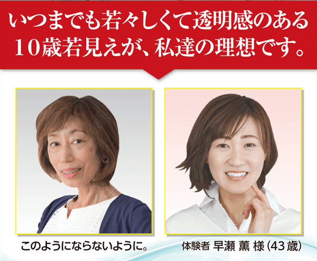 いつまでも若々しくて透明感のある10歳若見えが私たちの理想です！